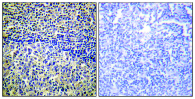 Anti-p47 PHOX antibody produced in