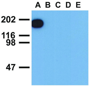 Monoclonal Anti-EGFR (PhosphoTyr1173) antibody produced