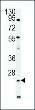 ANTI-LYPL1 (CENTER) antibody produced in