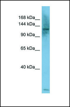 Anti-PLCB1 antibody produced in rabbit