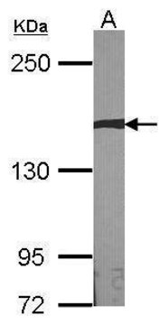 Anti-AUTS2 antibody produced in rabbit
