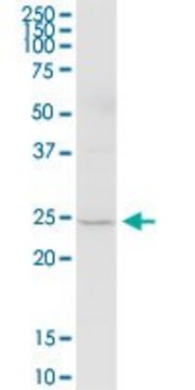 Anti-TMED5 antibody produced in mouse