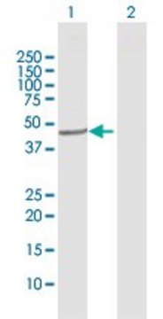 Anti-CYP20A1 antibody produced in rabbit