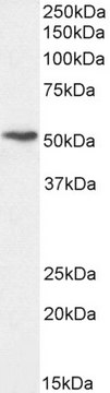 Anti-Perilipin, C-Terminal antibody produced in
