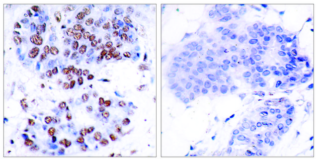 Anti-NF-?B p65 antibody produced in