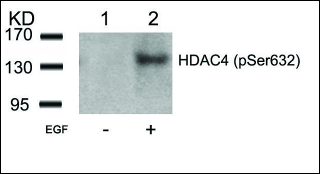 Anti-phospho-HDAC4 (pSer?³²) antibody produced in