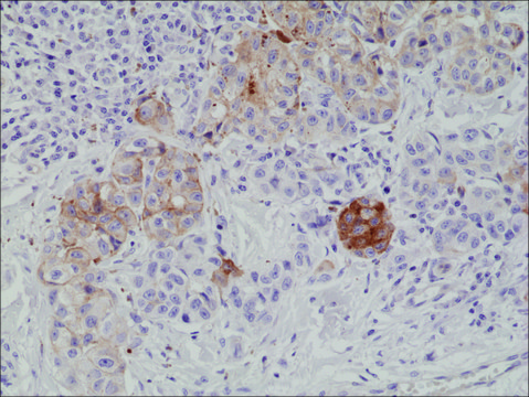 Anti-MART1 antibody, Rabbit monoclonal