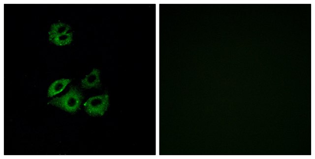 Anti-CCBP2 antibody produced in rabbit