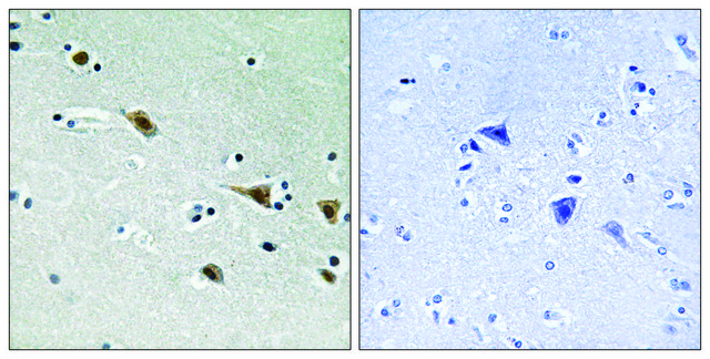 Anti-phospho-MAP2K7 (pSer²?¹) antibody produced in