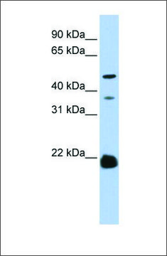 Anti-ZDHHC14 antibody produced in rabbit
