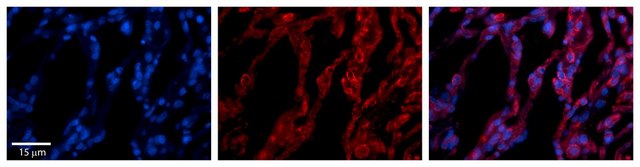 Anti-TAP1 antibody produced in rabbit