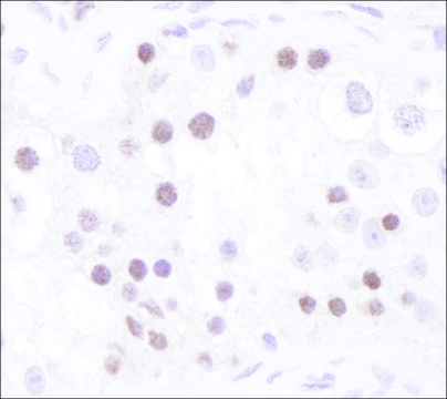 Rabbit anti-Chk1 Antibody, Affinity Purified