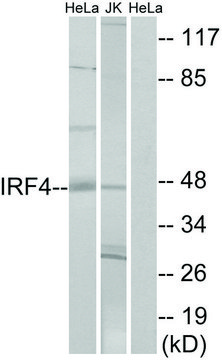 Anti-IRF4 antibody produced in rabbit