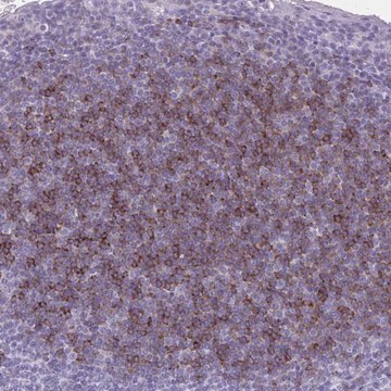 Anti-OR4B1 antibody produced in rabbit