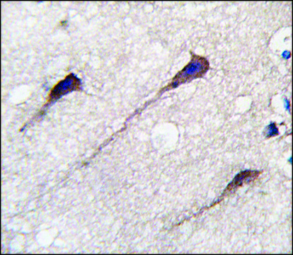 Anti-PUM1 (Y83) antibody produced in
