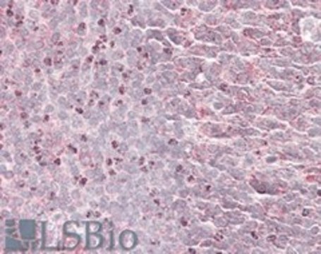 Anti-SEPT6 antibody produced in goat