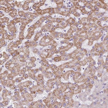 Anti-TMEM170A antibody produced in rabbit