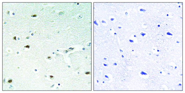 Anti-Retinoblastoma antibody produced in rabbit