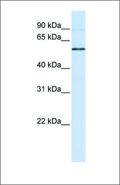 Anti-ESRRB antibody produced in rabbit