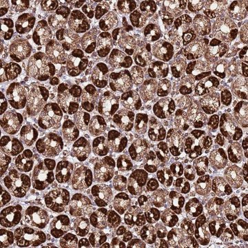 Anti-TM2D2 antibody produced in rabbit