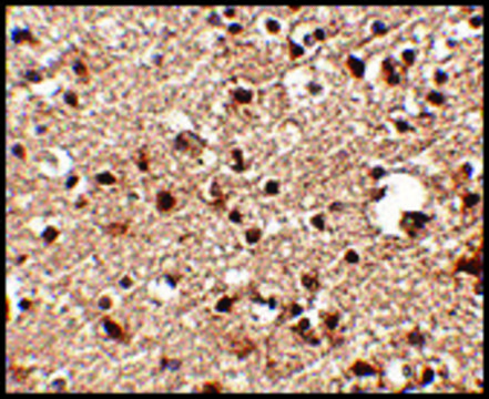 Anti-JPH4 (ab1) antibody produced in