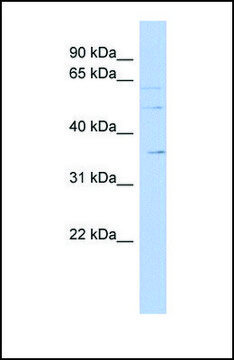 Anti-SLC22A17 antibody produced in rabbit