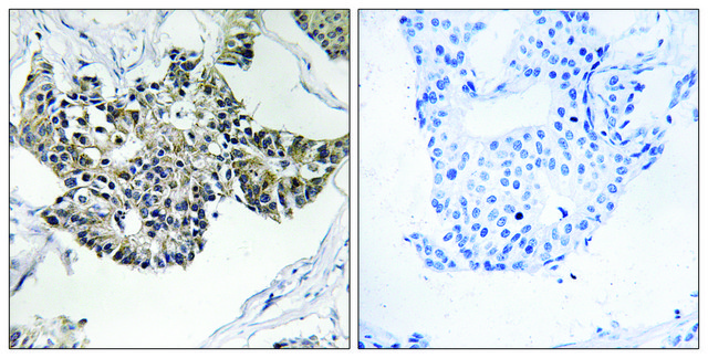 Anti-RSAD1 antibody produced in rabbit