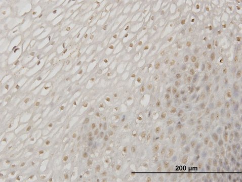 Monoclonal Anti-ERN1 antibody produced in