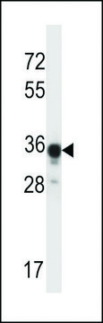 ANTI-ABHD4 (CENTER) antibody produced in