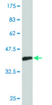 Monoclonal Anti-EXOSC5, (N-terminal) antibody produced