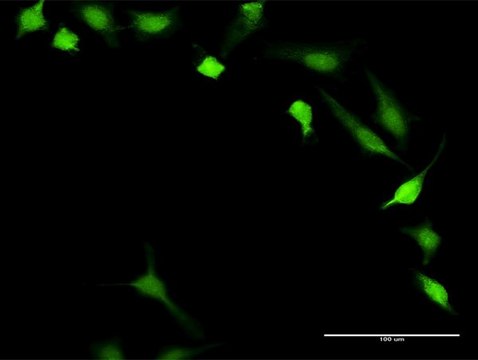 Anti-PPP3R1 antibody produced in rabbit