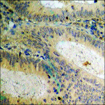Anti-phospho-Csk (pSer³??) antibody produced in