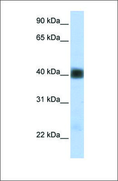 Anti-SGCB antibody produced in rabbit