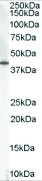 Anti-HSD3B1 antibody produced in goat