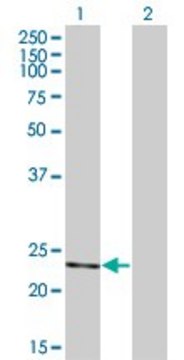 ANTI-RCV1 antibody produced in mouse
