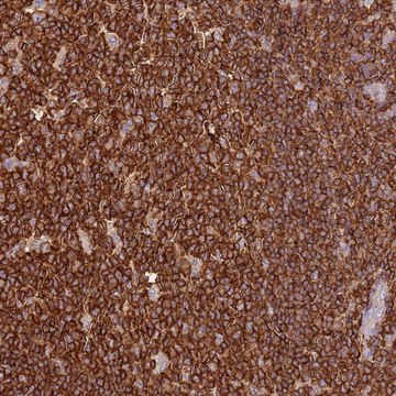 Anti-OR6P1 antibody produced in rabbit