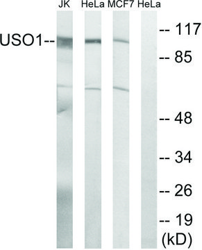 Anti-USO1 antibody produced in rabbit