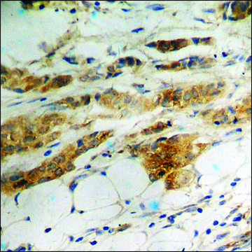 Anti-phospho-eIF2 ? (pSer?¹) antibody produced