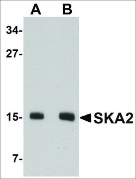Anti-SKA2 antibody produced in rabbit
