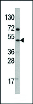 ANTI-VEGFD (VEGF4)(C-TERMINAL) antibody produced in