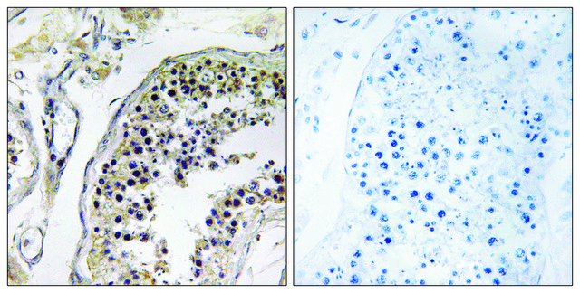 Anti-CNOT4 antibody produced in rabbit