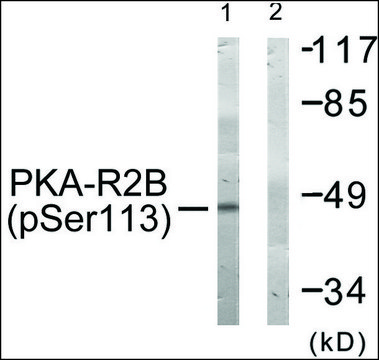 Anti-phospho-PKA-R2? (pSer¹¹³) antibody produced in