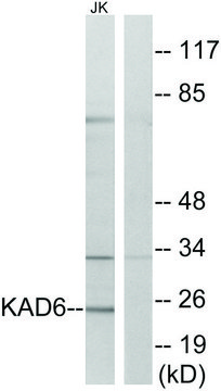 Anti-KAD6, N-Terminal antibody produced in
