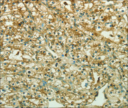 Anti-CTSV antibody produced in rabbit