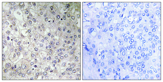 Anti-GIPR antibody produced in rabbit