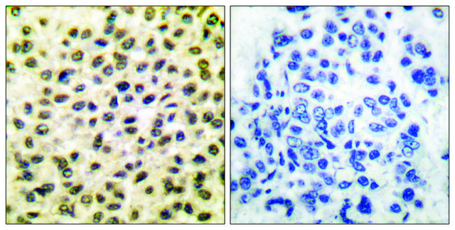 Anti-FOS antibody produced in rabbit