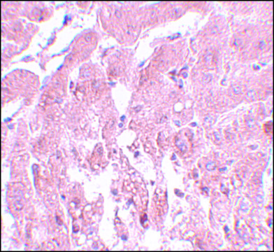 Anti-SUMO2/3 antibody produced in rabbit