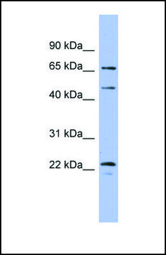 Anti-MAPK4 antibody produced in rabbit