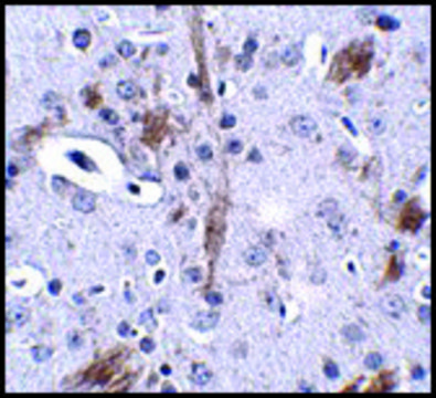 Anti-TTBK1 antibody produced in rabbit