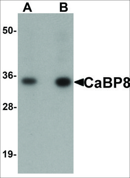Anti-CaBP8 antibody produced in rabbit